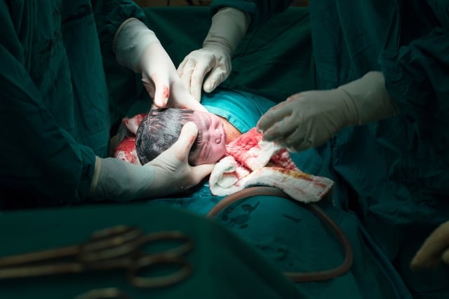 9 حالات يشار فيها إلى الولادة القيصرية 