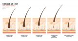 الهرمونات وتساقط الشعر: ما هي هرمونات تساقط الشعر