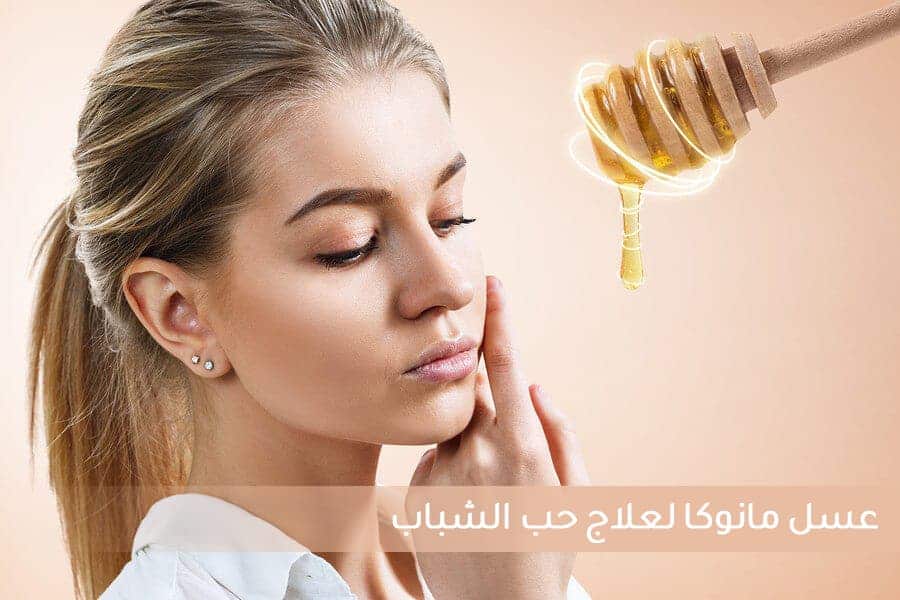 miel de manuka para el acne